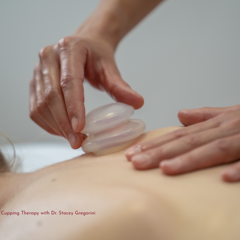 Cupping Therapy with Dr. Stacey Gregorini